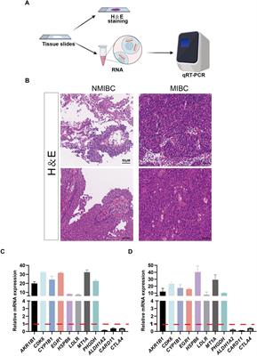 Integrating oxidative-stress biomarkers into a precision oncology risk-stratification model for bladder cancer prognosis and therapy